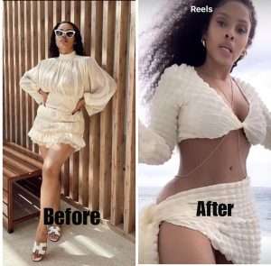 Before and After surgery Kefilwe Mabote 